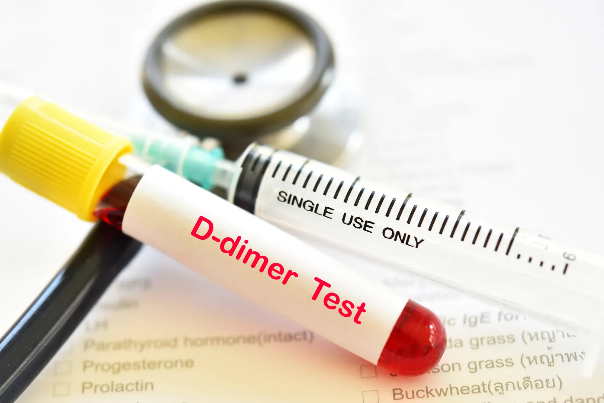 D-Dimer Test